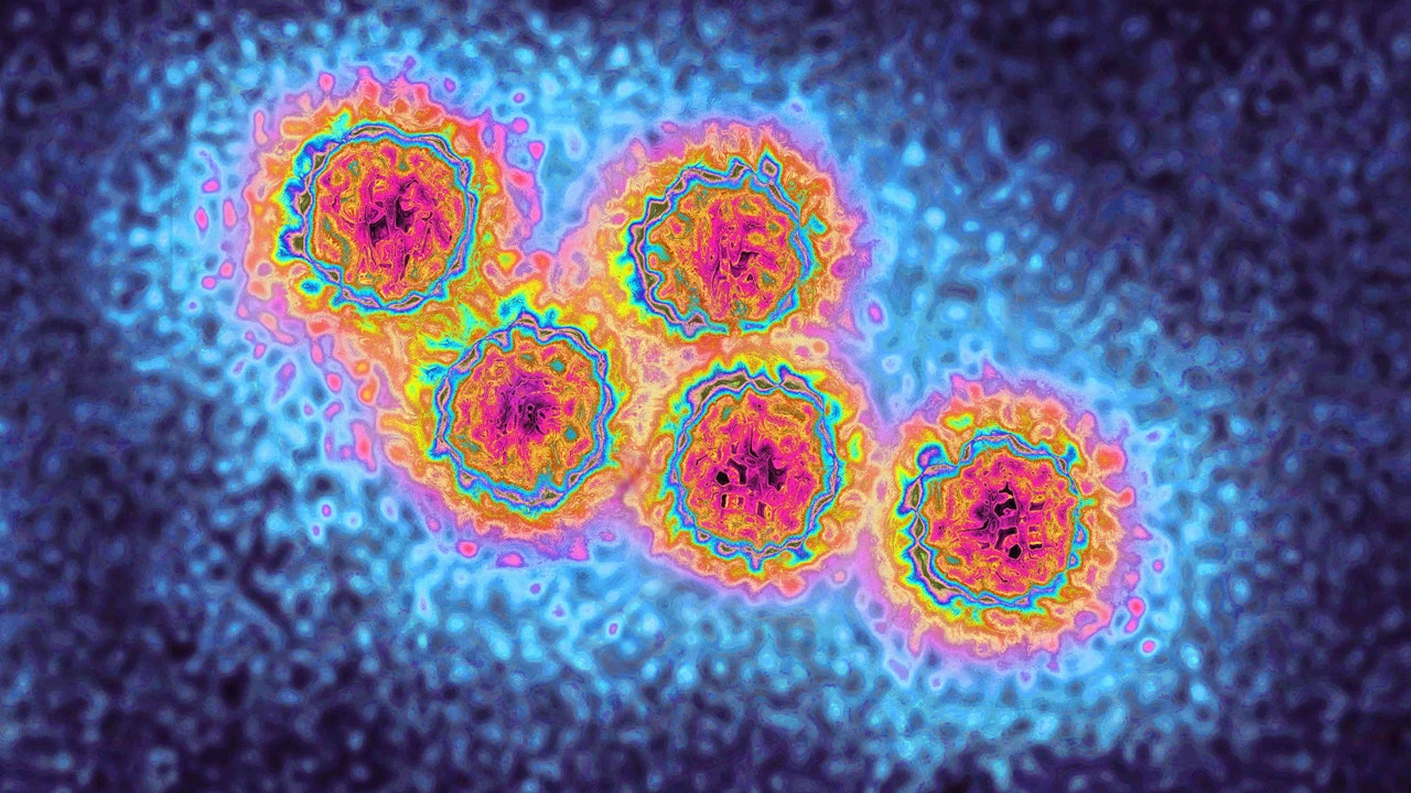 Hepatitis A outbreak infects thousands of travelers at popular destinations