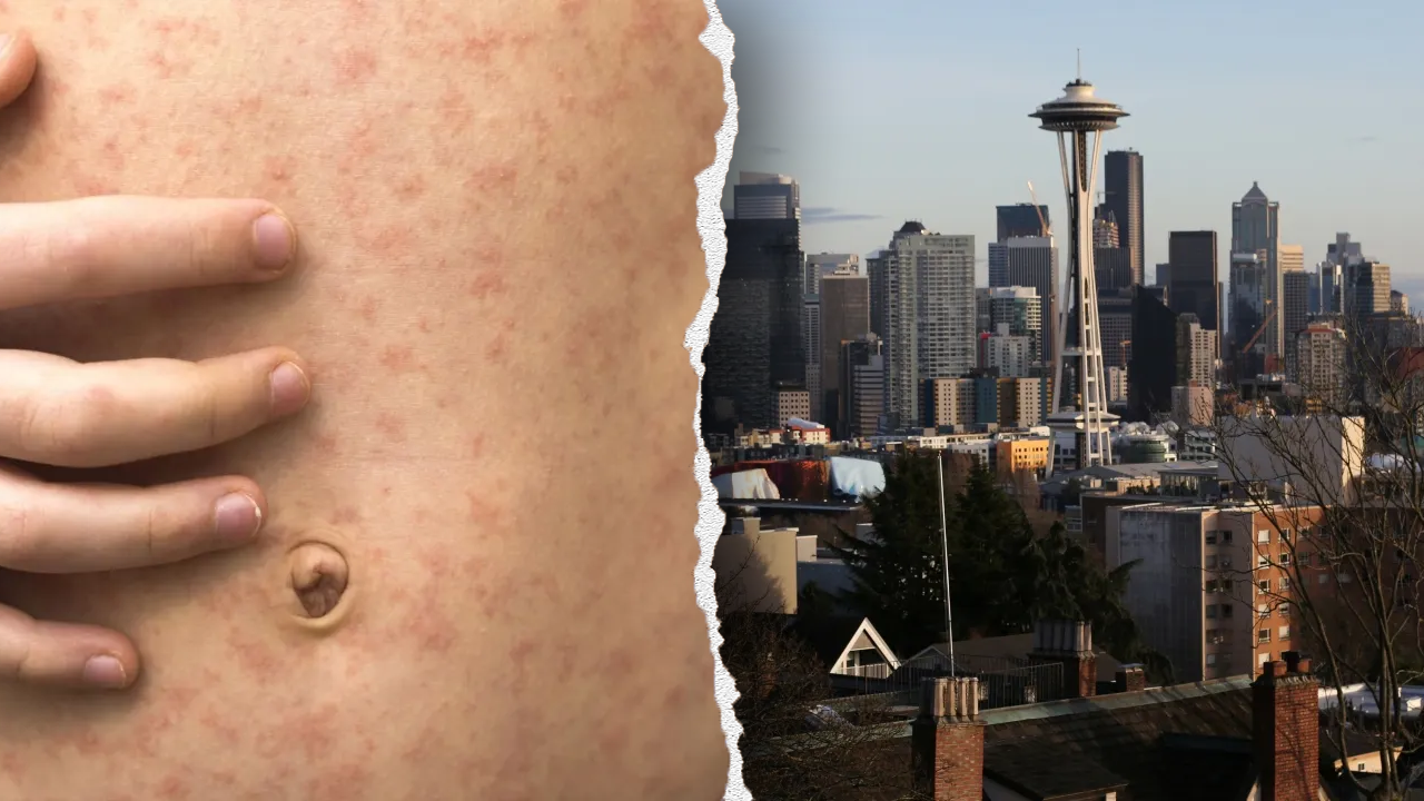 Officials in West Coast state sound alarm after traveler diagnosed with highly contagious viral disease