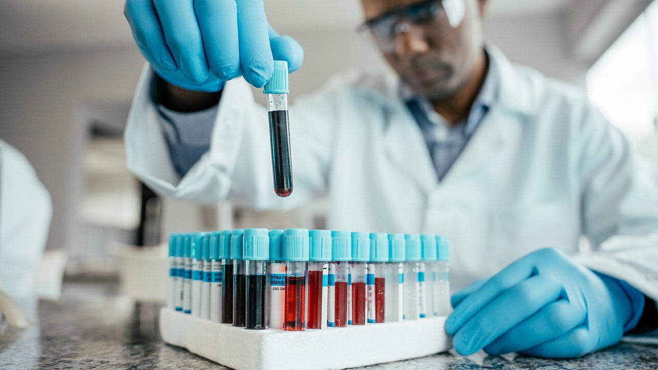 The ‘age’ of your blood could predict dementia risk, new study suggests The ‘age’ of your blood could predict dementia risk, new study suggests