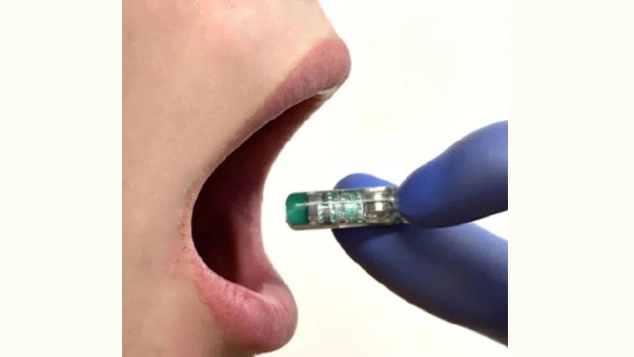 Swallow this pill to learn about your gut and health