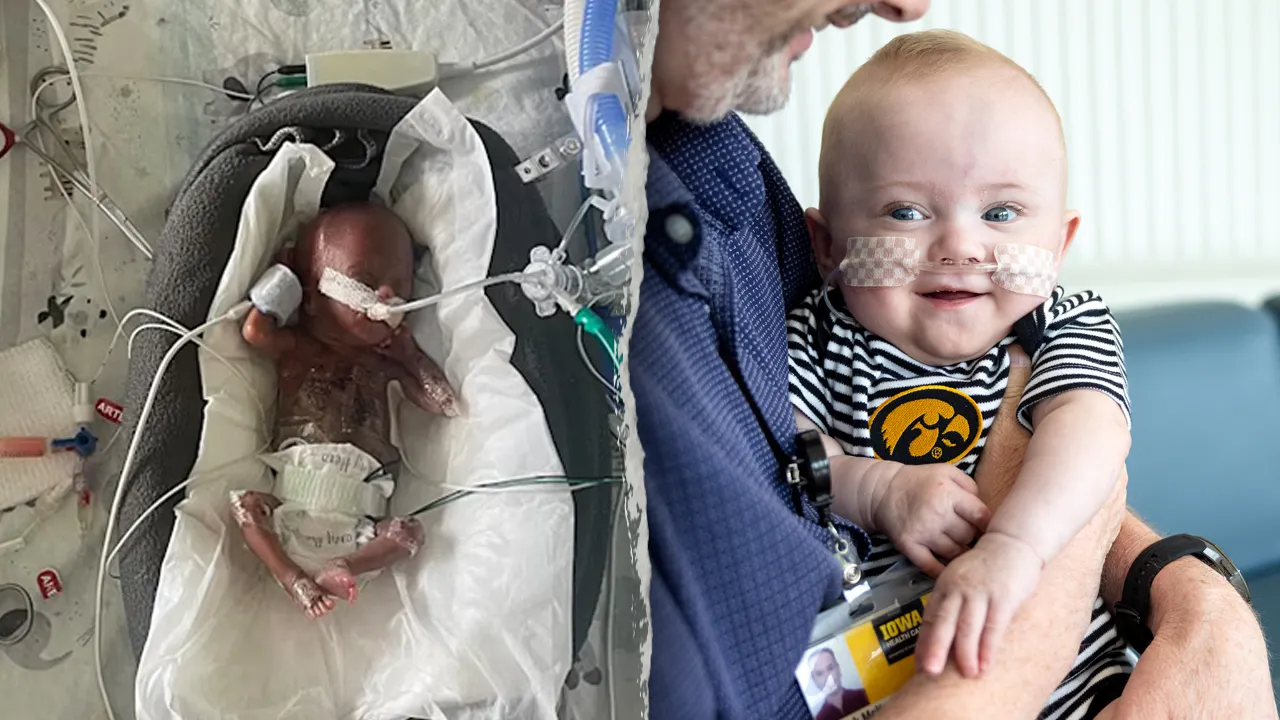 World’s most premature baby defies all medical odds to reach 1st birthday