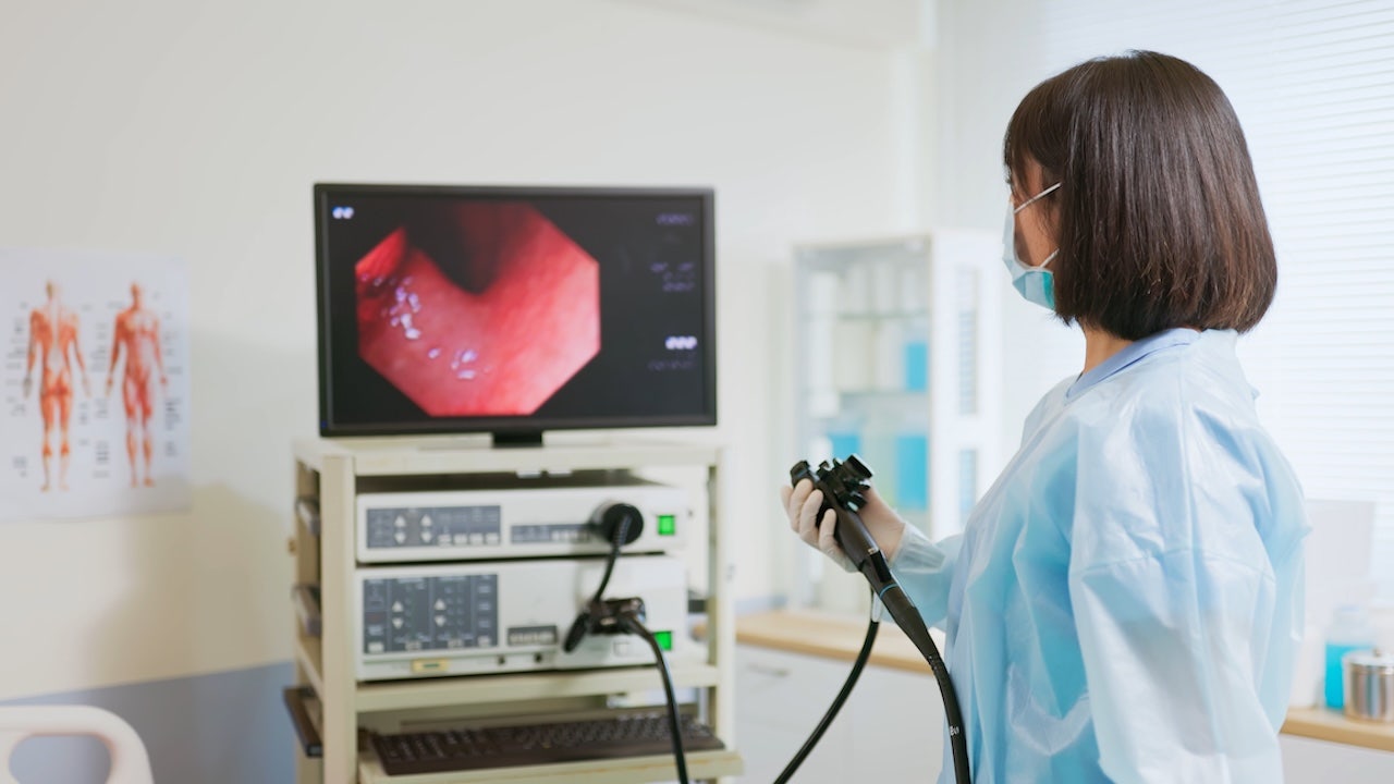 Colon cancer may be missed as doctors rely on AI, alarming study warns