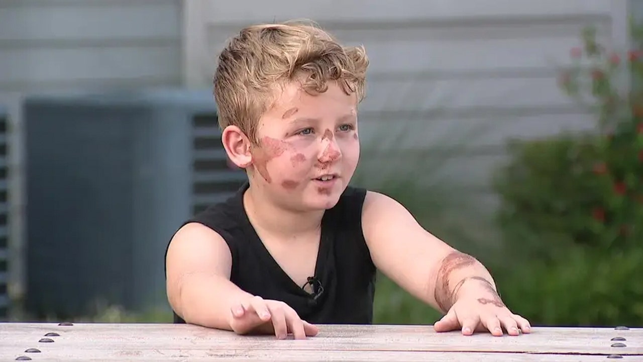 Fort Worth, TX, police search for hit-and-run driver who struck 8-year-old boy