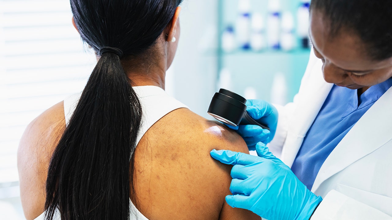 Vitamin B3 linked to lower skin cancer risk in new research findings