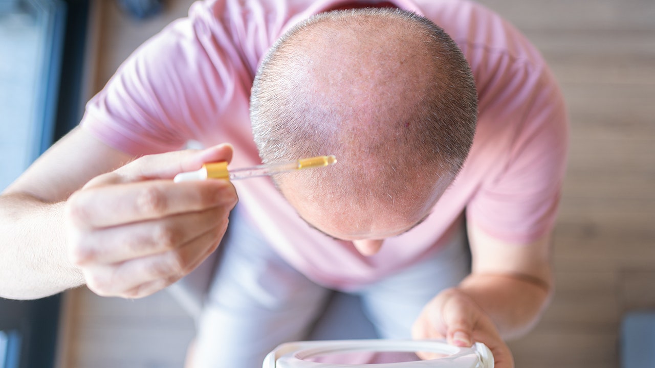 Experimental serum shows promise in reversing baldness within 20 days