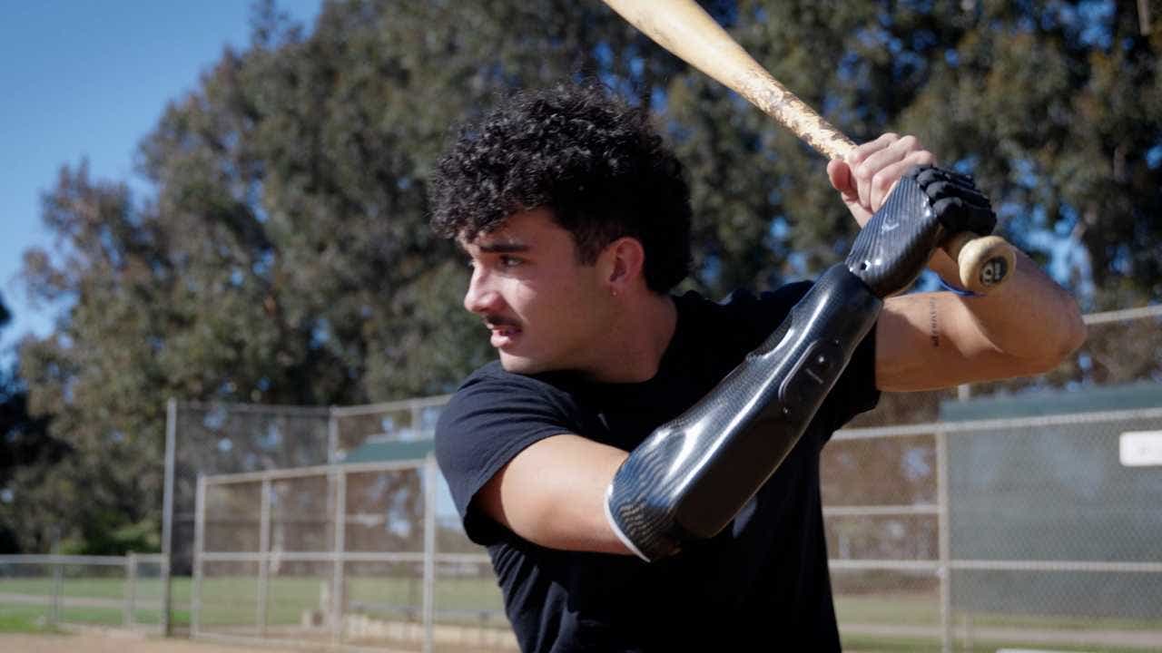 Bionic hand brings baseball star back to the field