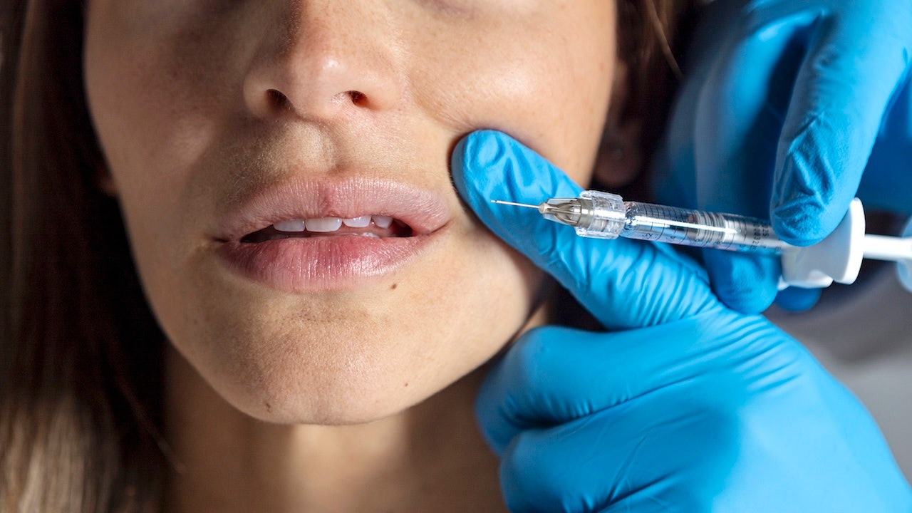 Cosmetic fillers can cause deadly complication, experts warn — but new tech exposes it Cosmetic fillers can cause deadly complication, experts warn — but new tech exposes it