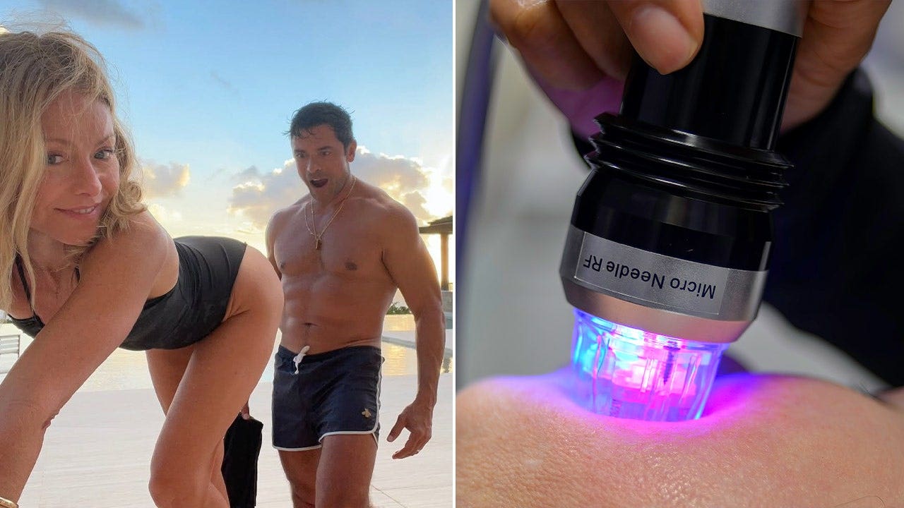 What is butt microneedling? Behind the 'desperate' procedure Kelly Ripa tried