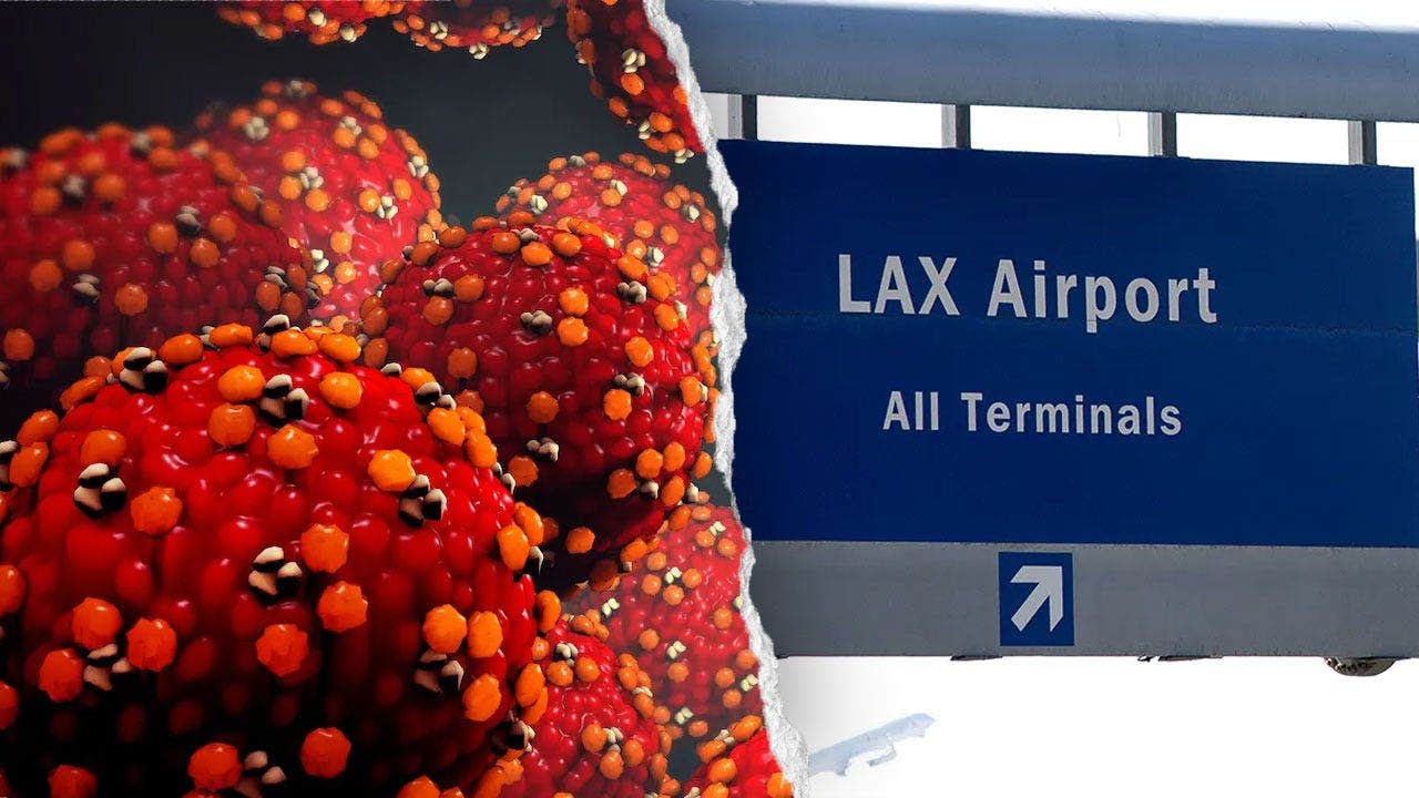 Measles-infected traveler may have exposed passengers at LAX and nearby hotel, health officials warn Measles-infected traveler may have exposed passengers at LAX and nearby hotel, health officials warn