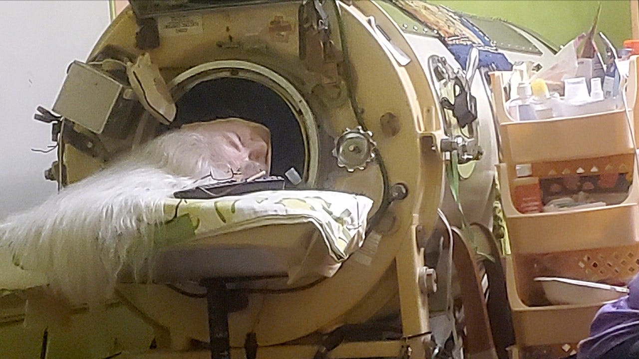 Polio survivor who was last American iron lung user dies at age 78 Polio survivor who was last American iron lung user dies at age 78