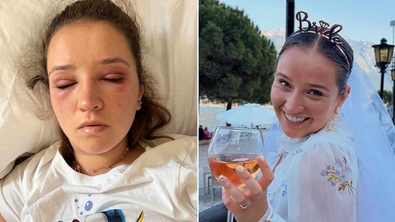 Bride cautions others before wedding day about risky beauty treatments: ‘Pain wasn’t worth it’ Bride cautions others before wedding day about risky beauty treatments: ‘Pain wasn’t worth it’