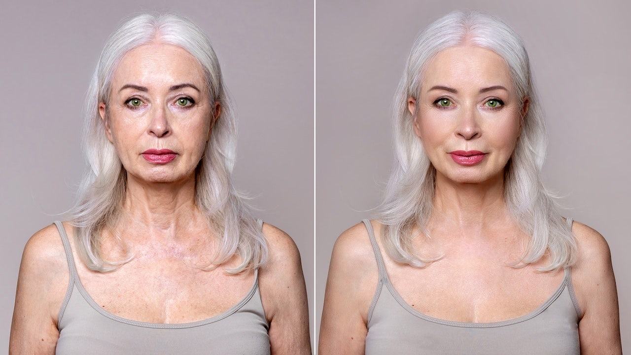 Celebrity plastic surgeon reveals when it's too soon for a facelift, and when waiting can backfire Celebrity plastic surgeon reveals when it's too soon for a facelift, and when waiting can backfire