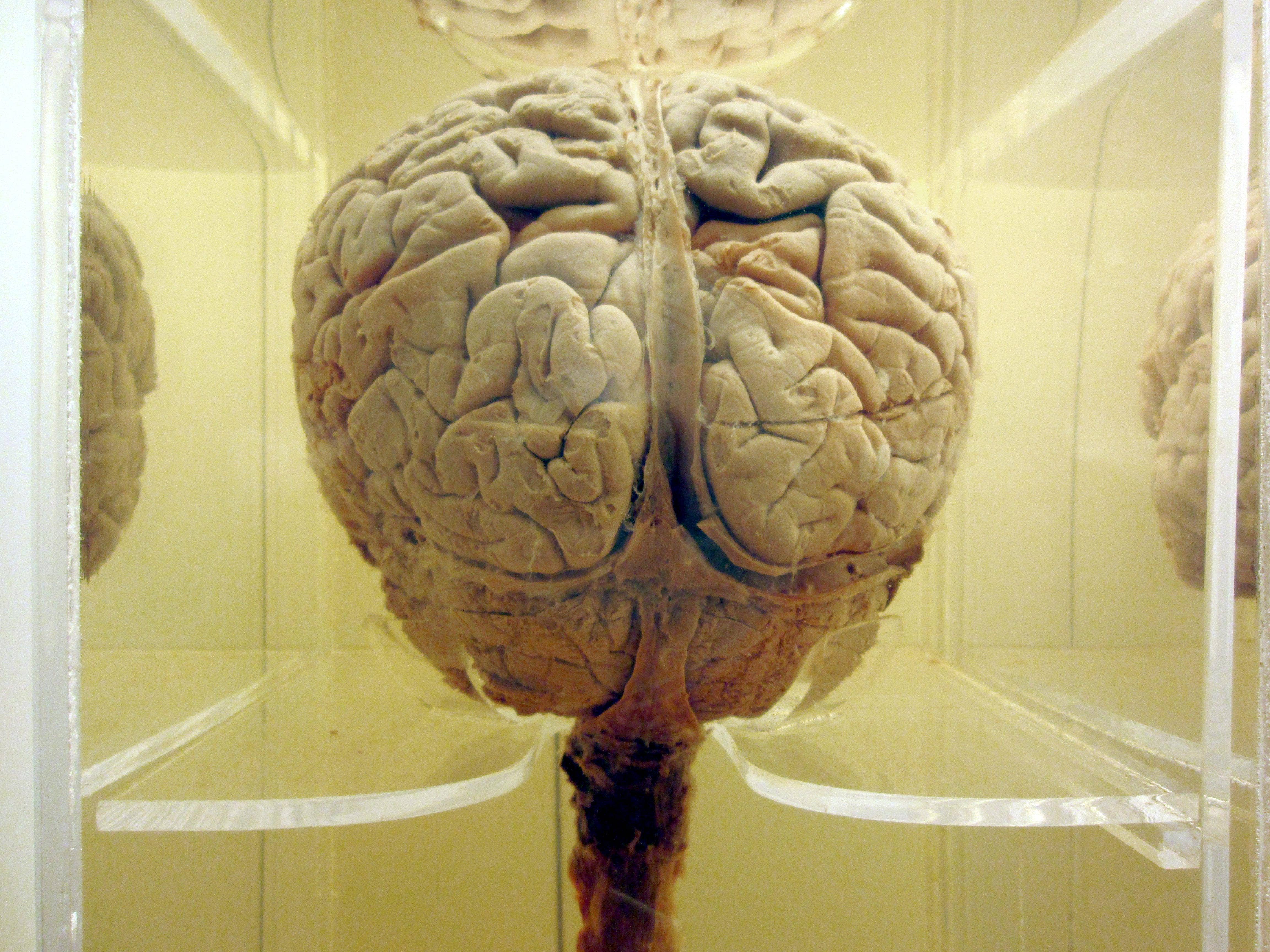 Настоящий человеческий. Головной мозг настоящий. Реальный человеческий мозг.